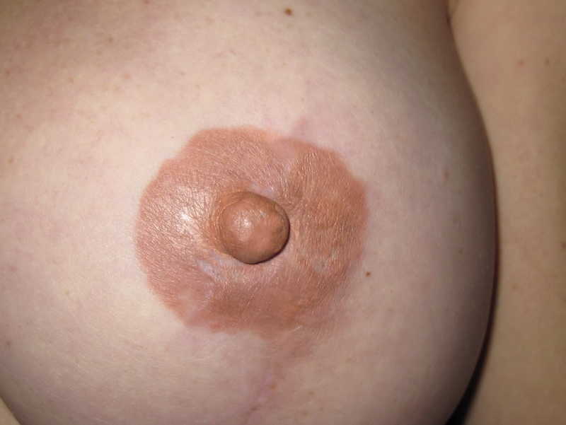 إصلاح الحلمة والهالة